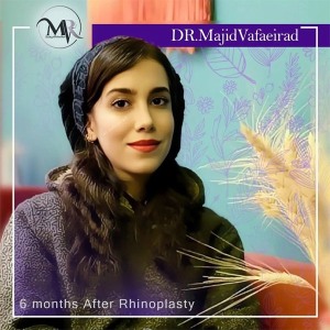 جراحی-بینی-38