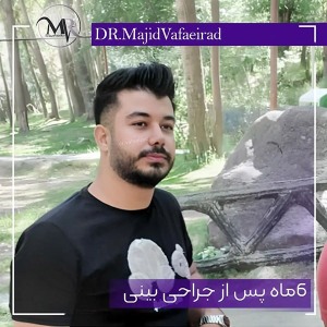 جراحی-بینی-40