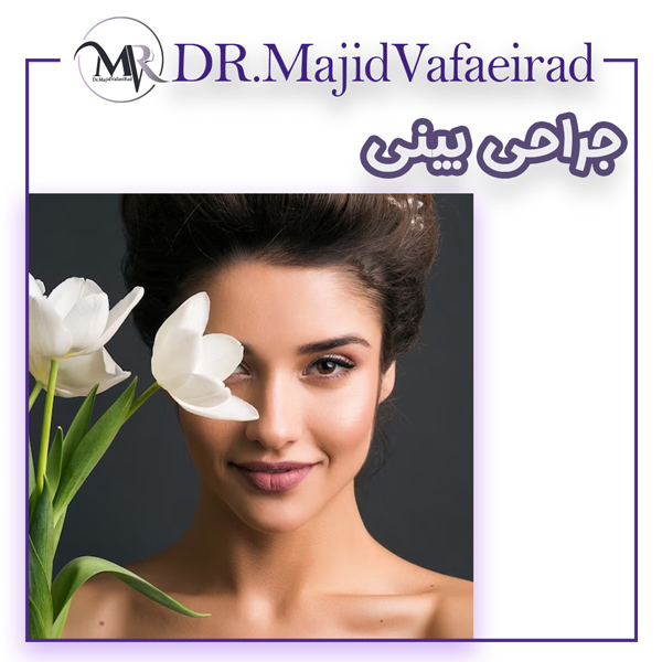 عمل زیبایی بینی در همدان - دکتر وفایی راد