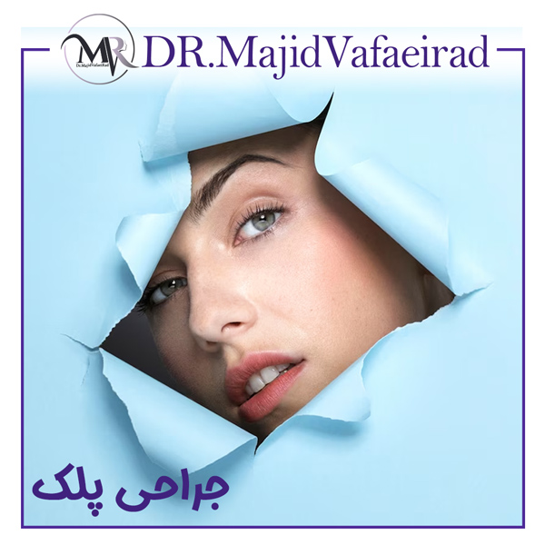 جراحی پلک - دکتر مجید وفایی راد