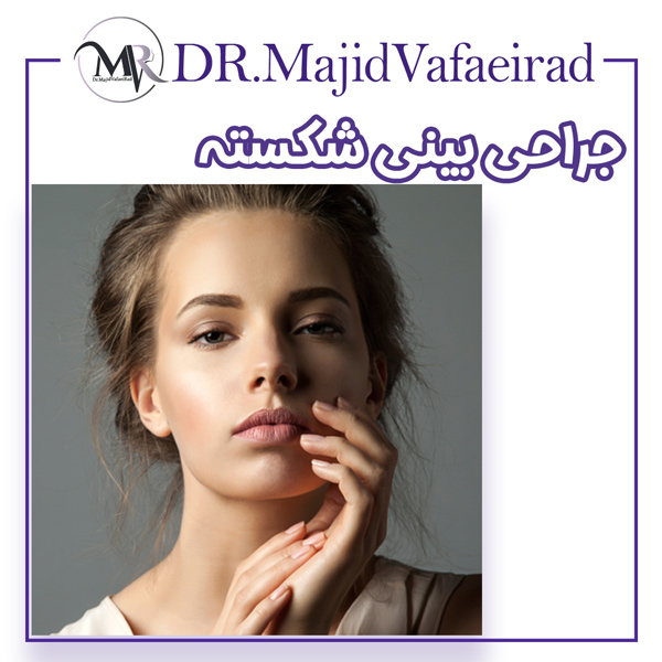 جراحی بینی شکسته - دکتر مجید وفایی راد