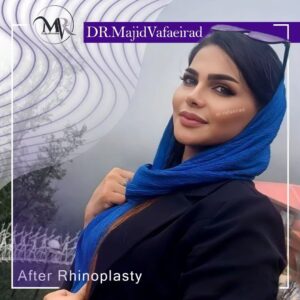 جراحی بینی استخوانی - دکتر مجید وفایی راد
