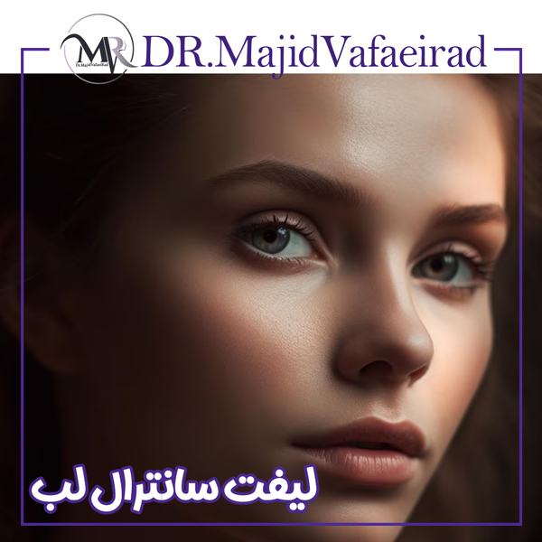 لیفت سانترال لب - دکتر مجید وفایی راد