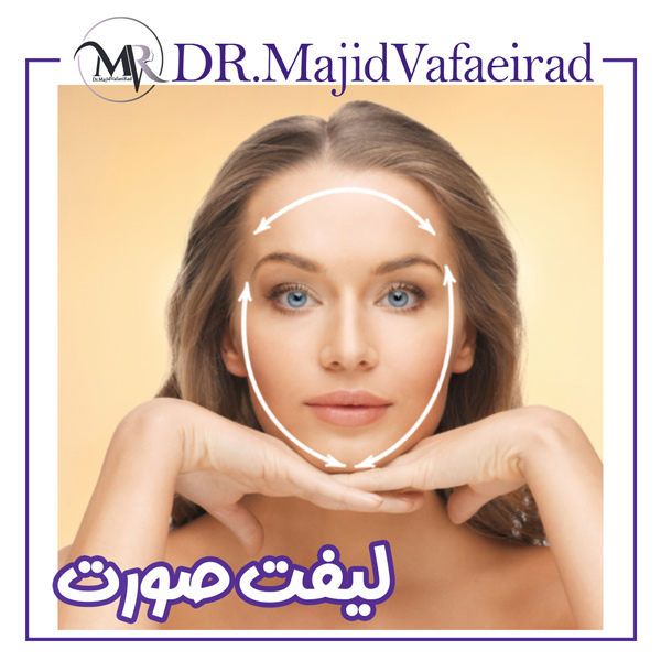 لیفت صورت - دکتر مجید وفایی راد