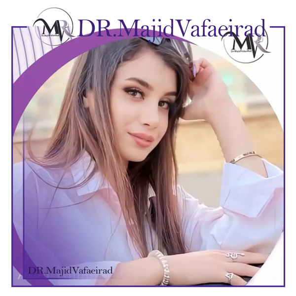 جراحی بینی کج - دکتر مجید وفایی راد