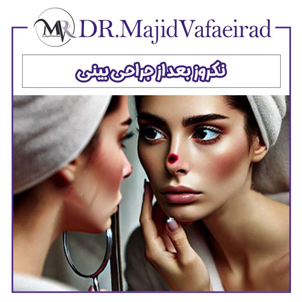 نکروز بعد از جراحی بینی