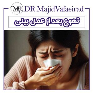 تهوع بعد از عمل بینی