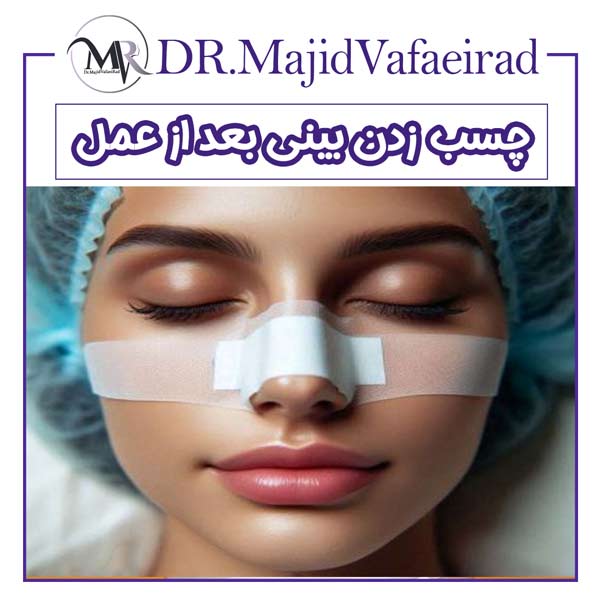 چسب زدن بینی بعد از عمل