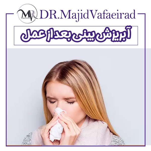 آبریزش بینی بعد از عمل
