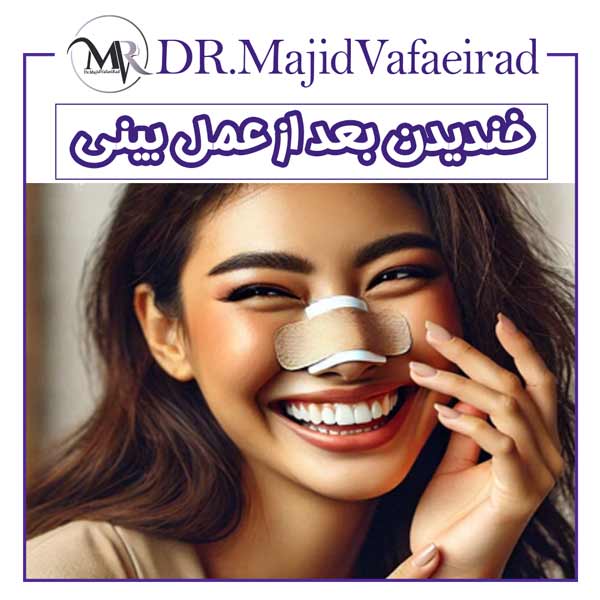 خندیدن بعد از عمل بینی