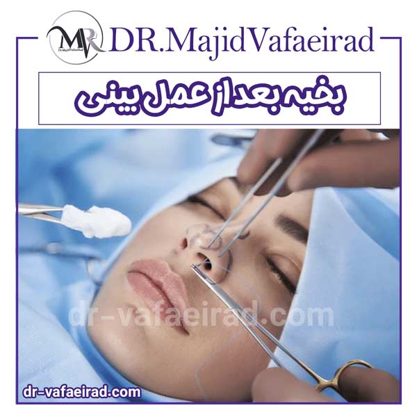 بخیه بعد از عمل بینی - دکتر محید وفایی راد - بهترین جراح بینی همدان
