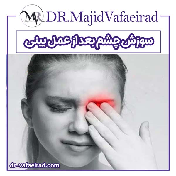 سوزش چشم بعد از عمل بینی