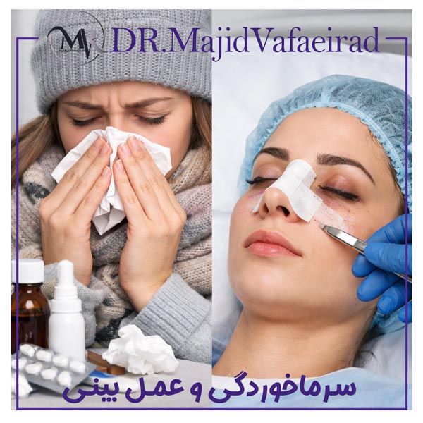 سرماخوردگی و عمل بینی - دکتر وفایی راد
