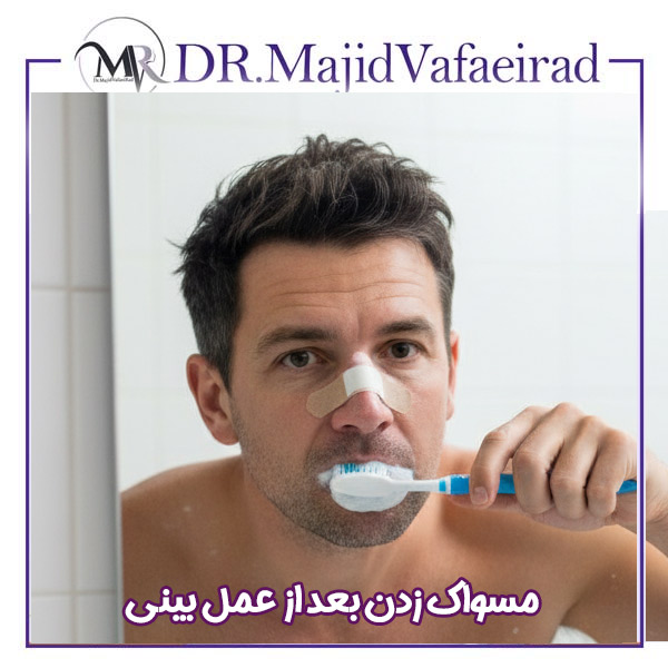 مسواک زدن بعد از عمل بینی -دکتر مجید وفایی راد